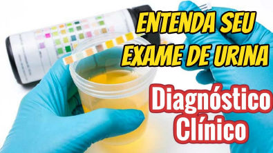 ✓DIAGNÓSTICO - Interpretando exames clínicos #2 - Urinálise, Exame de Urina como entender!