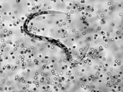 Eosinófilos humanos atacando a un gusano helminto (2)