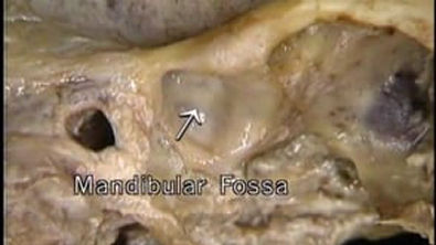 Anatomia General Articulacion Temporo mandibular ATM Joint