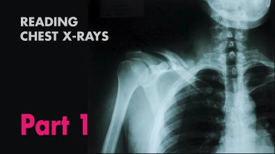 Anatomy of a Chest X-Ray - How to Read a Chest X-Ray (Part 1) - MEDZCOOL