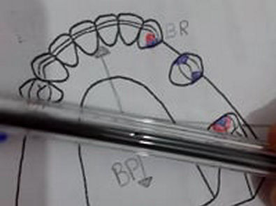 biomecanica da PPR