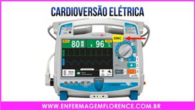 Você sabe a diferença de Desfibrilação e Cardioversão Elétrica_