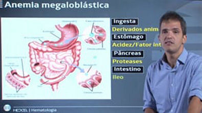 3 - Anemias hiporproliferativas - Anemia Megaloblástica - curto