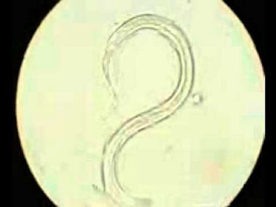 Dictyocaulus filaria larva