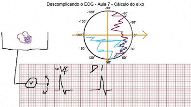 Descomplicando o ECG - Aula 7 - Cálculo do eixo