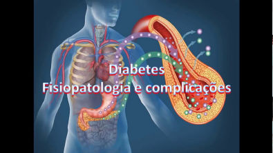 Diabetes : Fisiopatologia e complicações PARTE 01 ( Introdução )