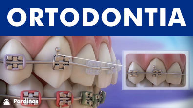 Ortodontia - Peças e função do aparelho ortodontico ©