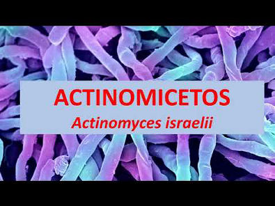 Microbiologia Médica: Actinomyces israelli Actinomicetos