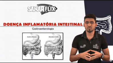 Doenças inflamatórias intestinais - Doença de Crohn e Retocolite Ulcerativa - Aula SanarFlix