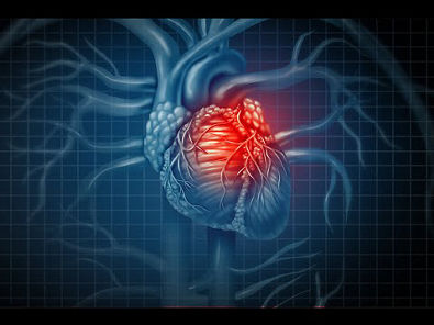 Emergências relacionadas a doenças cardiovasculares