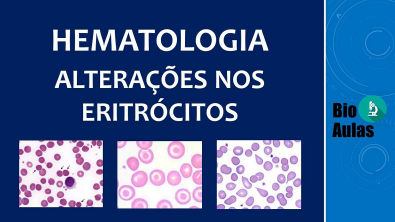 Anisocromia, Anisocitose e Poiquilocitose: Alterações no Hemograma (Hematologia) - Bio Aulas