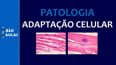 Adaptação Celular: Hipertrofia, Hiperplasia, Hipotrofia, Metaplasia (Patologia Geral) - Bio Aulas